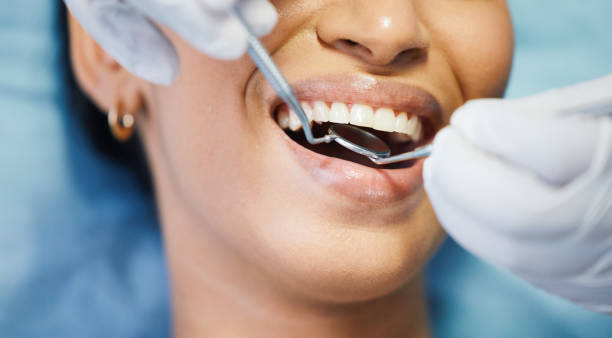 Best Teeth Whitening  in Brownsville, LA