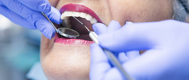 Urgent Tooth Repair in LA
